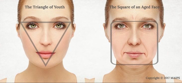 Wrinkles – Causes and Treatments